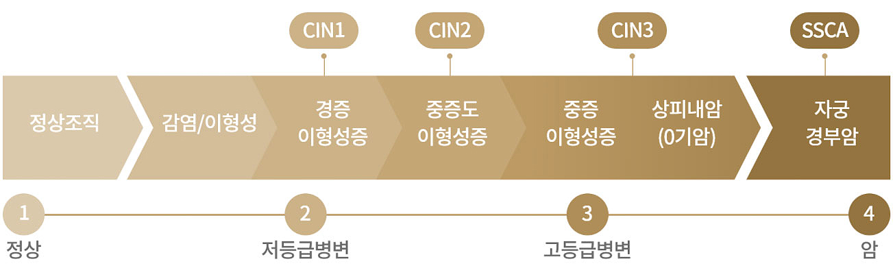 발생부위