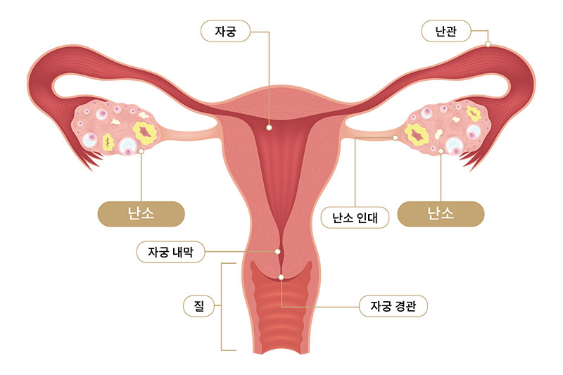 발생부위